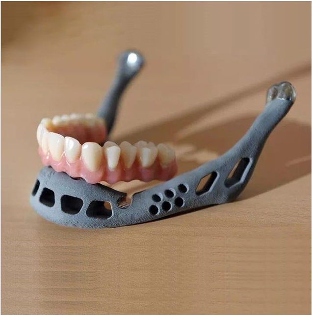 郑州3D打印齿科