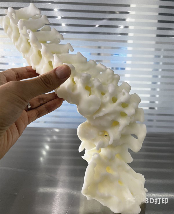 郑州3D打印骨骼